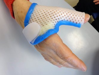 orthèse de pouce attelle arthrose rhizarthrose inflammation entorse